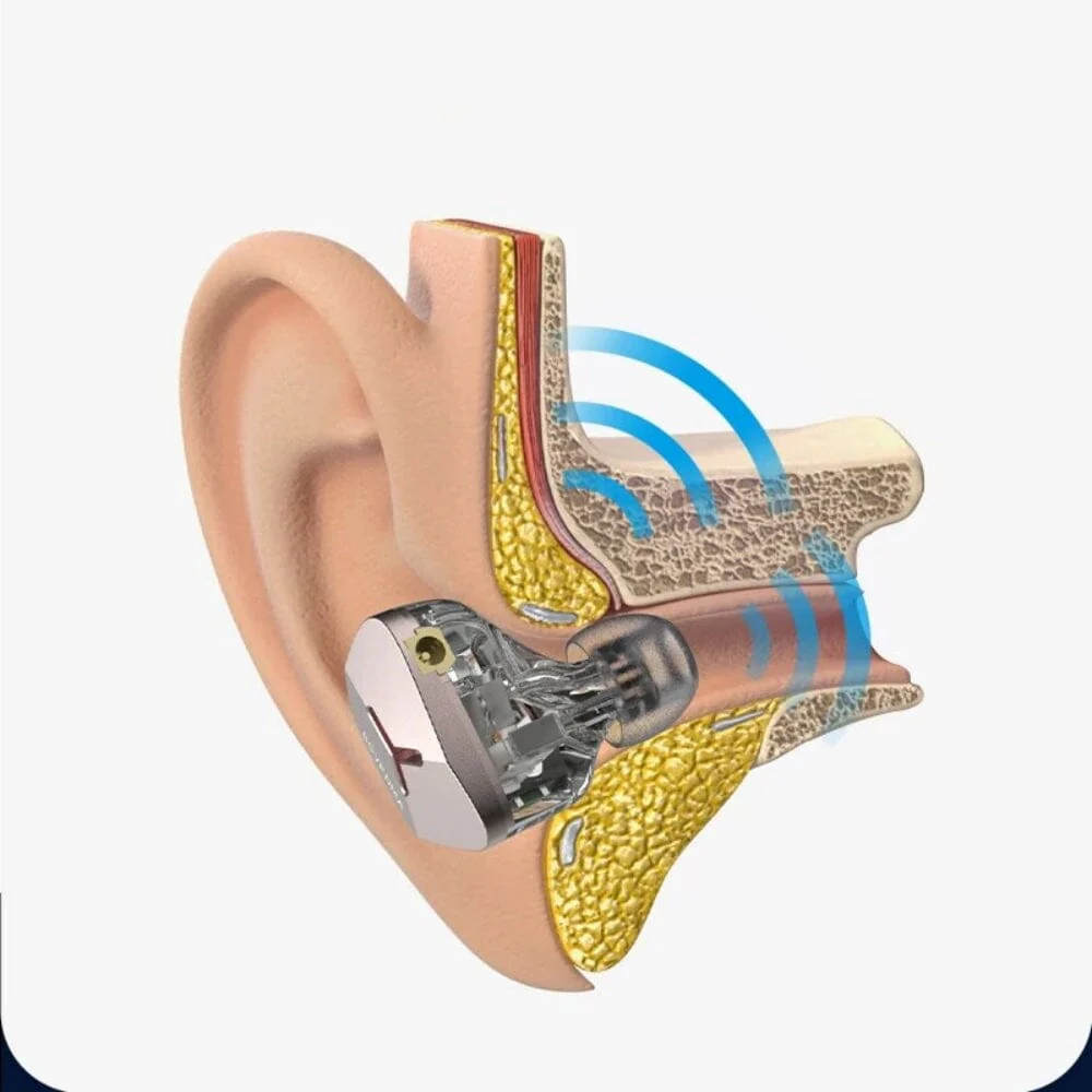 BGVP DMA 1DD + 2BA + 2BCD Hybrid Bone Conduction In-Ear Earphone - Image 5